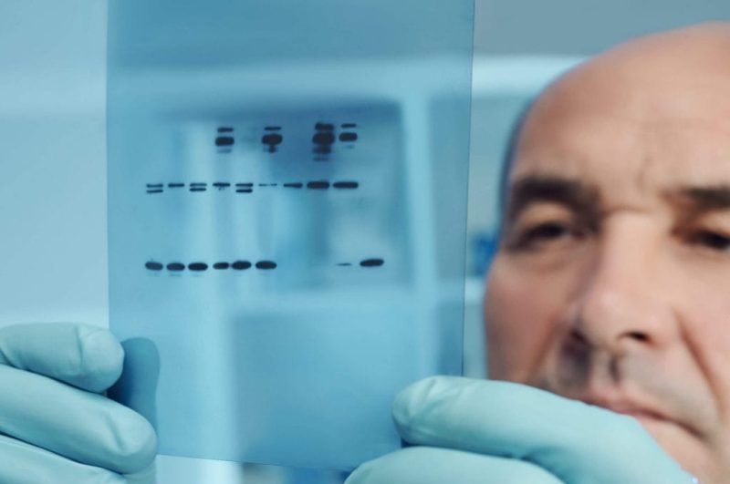 Western Blot and Immunoglobulin Products